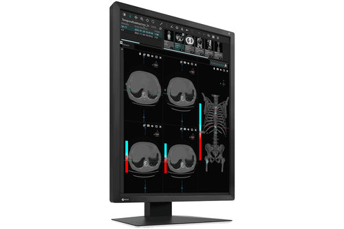 MX-SERIES21.3IN LCD LED COLOR DICOM CALIB BLK INTEG FRONT SENSOR