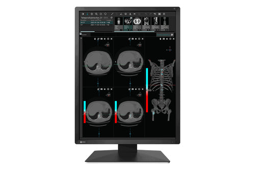 MX-SERIES21.3IN LCD LED COLOR DICOM CALIB BLK INTEG FRONT SENSOR