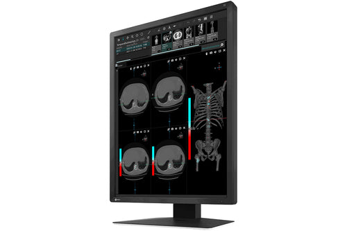 MX-SERIES21.3IN LCD LED COLOR DICOM CALIB BLK INTEG FRONT SENSOR
